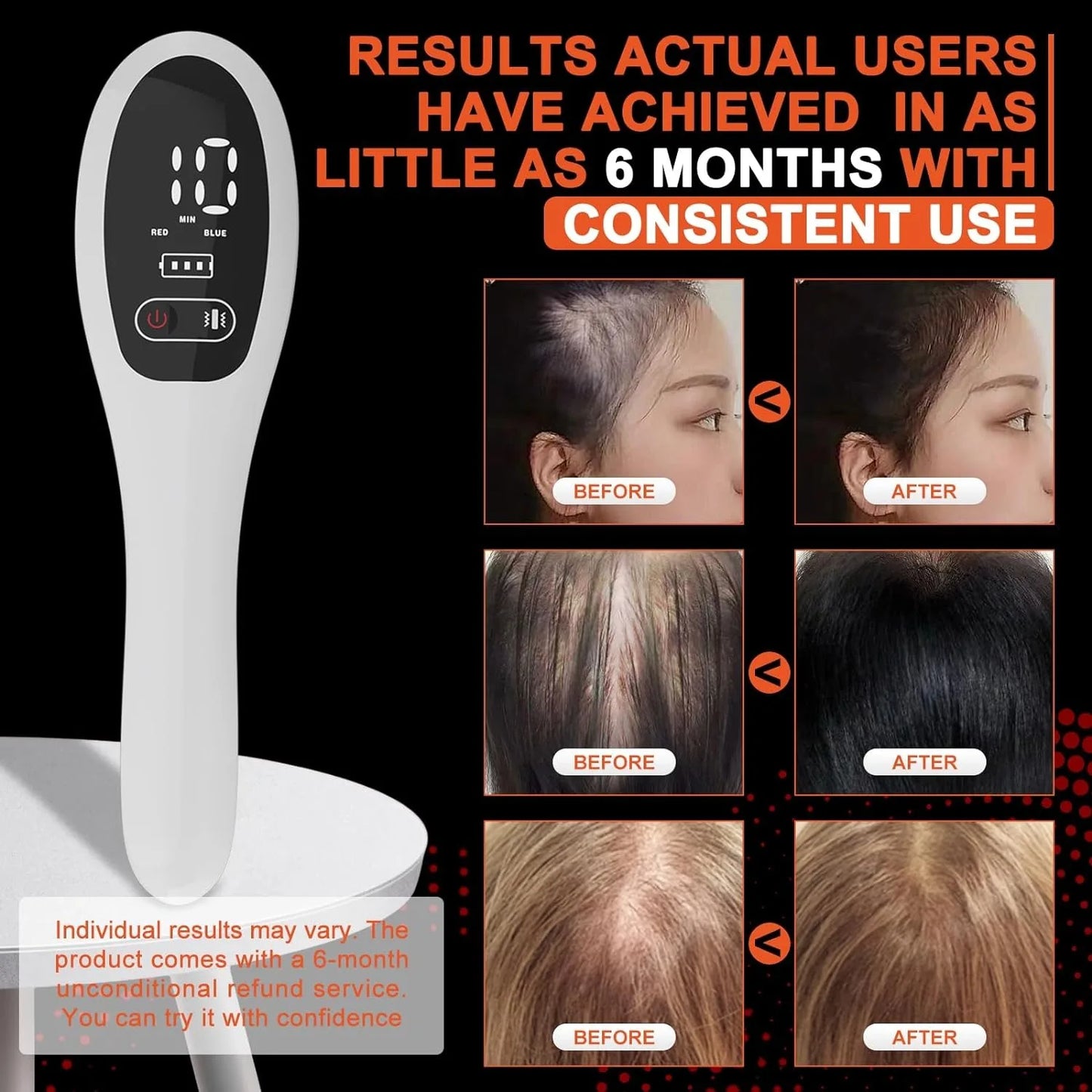 Electric Laser Hair Growth Comb Hair Therapy Comb Vibration Massage Hair Care Brush
